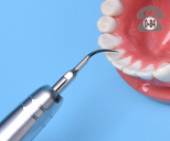 Профессиональная гигиена полости рта цены