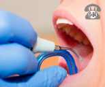 Профессиональная гигиена полости рта цены