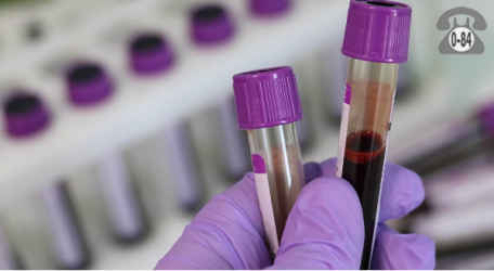 Анализ крови гемоглобин гликированный для взрослых без выезда
