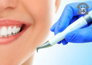 Профессиональная гигиена полости рта цены